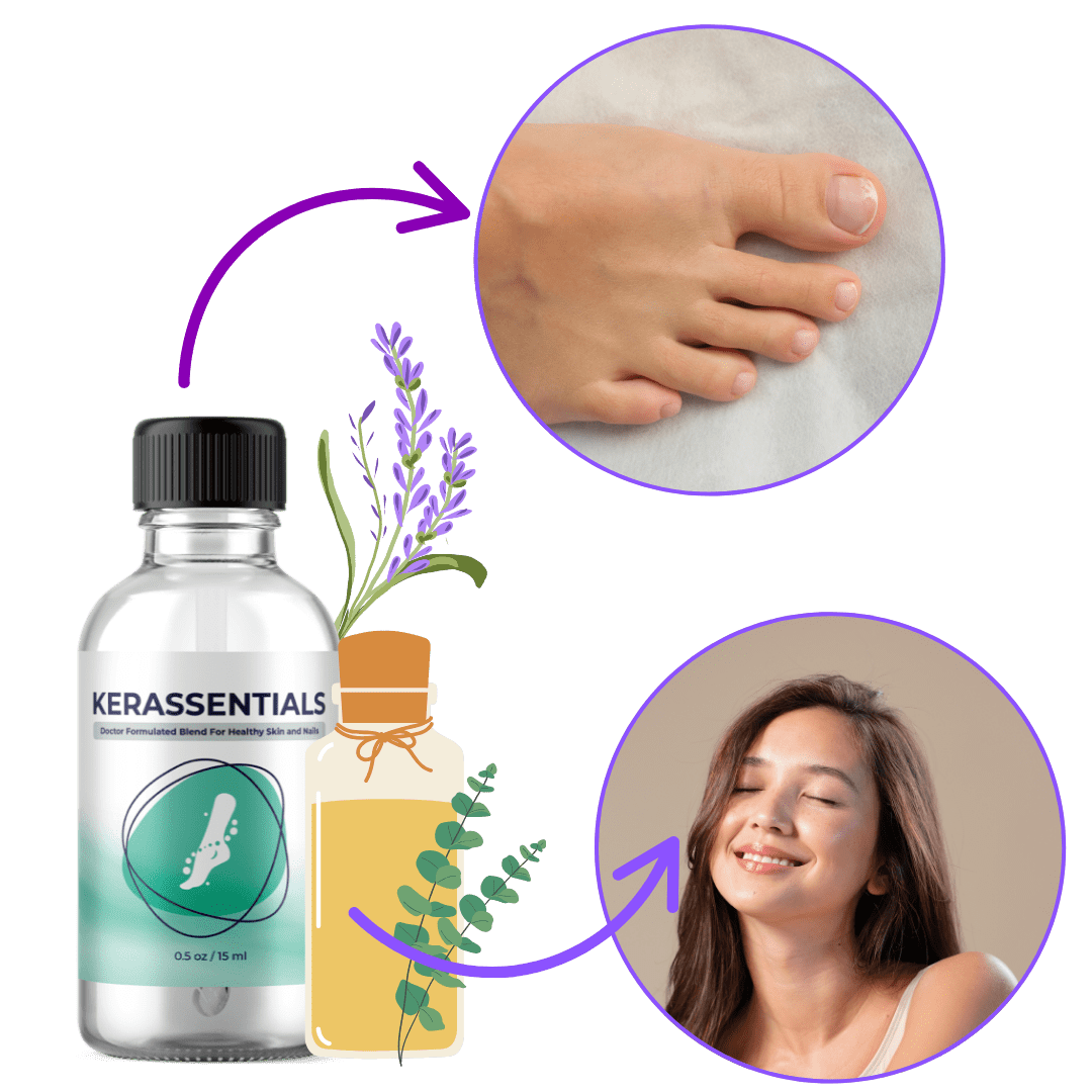 How Kerassentials works